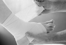 Why Choose Arizonafoot For Expert Ankle Ligament Surgery